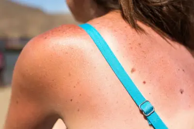 Préparer sa peau au soleil : un mythe dangereux démonté par la science