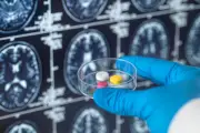 Alzheimer : 125 ans après sa découverte, pourquoi aucun traitement efficace n'existe ?