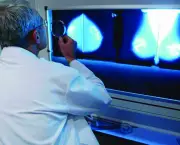 Dépistage du cancer du sein : des dizaines de milliers de vies sauvées selon l'Institut national du cancer