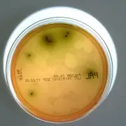 Listériose en Drôme : 12 cas et 2 décès liés à des charcuteries contaminées