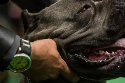 Oise : un enfant mordu cinq fois par des chiens, son pronostic vital écarté