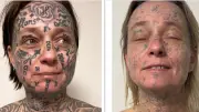 Pays-Bas : une femme forcée à 250 tatouages par son ex-compagnon lance une campagne de détatouage