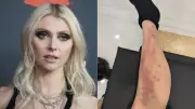 Taylor Momsen mordue par une araignée venimeuse : hospitalisée avant son concert avec AC/DC