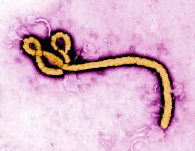 Ebola : origine, symptômes, traitements, le profil d'un virus tueur en RDC