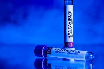 Hantavirus : un cas contact accueilli au CHU de Rennes, le Pr Tattevin rassure