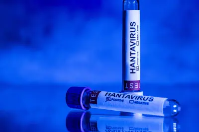 Hantavirus : une menace comparable au Covid ? Décryptage avec une infectiologue