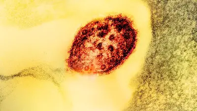 Pourquoi la rougeole fait-elle son retour en France malgré le vaccin ?