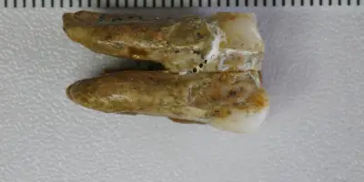 Un email de dents vieilles de 400 000 ans révèle des croisements d'hominines