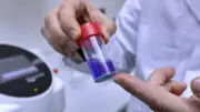 Additifs alimentaires : jusqu'à +49% de risque de diabète selon une étude