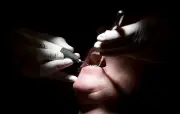 Ancien dentiste jugé pour avoir mutilé des patients en Lozère