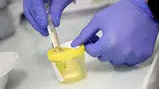 Cadmium : alerte du Dr Souvet sur un toxique 