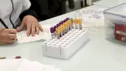 Cancer du pancréas : un Toulousain lance une pétition contre le cadmium
