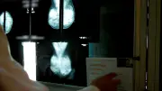 Cancer du sein : une pétition pour l'application de la loi
