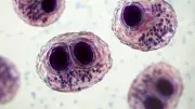 Cancer : le cytomégalovirus ouvre une nouvelle piste contre le glioblastome