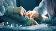 Chirurgien confond foie et rate : un patient de 70 ans meurt