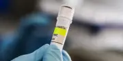 Hantavirus : que sait-on sur cette famille de virus ?