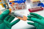 Hantavirus : séquençage du virus des croisiéristes du MV Hondius