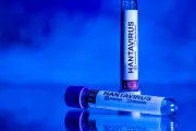 Hantavirus : un cas contact accueilli au CHU de Rennes, le Pr Tattevin rassure