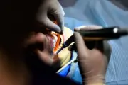 Lozère : des patients mutilés racontent leur calvaire face à l'ex-dentiste jugé