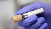 Test cadmium : 8,99 µg/g, un taux alarmant qui interroge