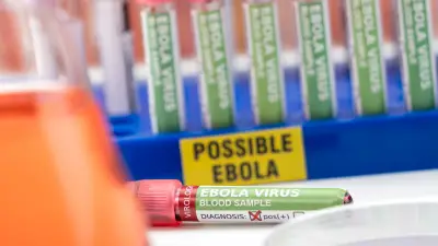 Ebola en France : patient isolé, cas contacts identifiés, faible risque