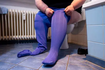 Lipoedème : des femmes racontent leur calvaire pour être soignées