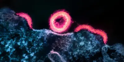 VIH : comment le virus reprogramme les cellules pour entrer dans leur noyau