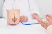 Cancer du sein après 70 ans : sous-représentation et soins personnalisés