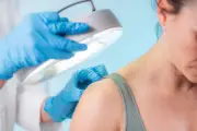 Médecins spécialistes : un rapport somme l'exécutif de réguler les dépassements d'honoraires