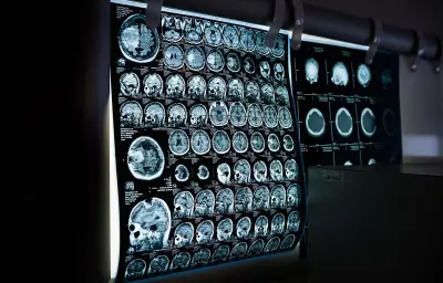 Un Gallois de 34 ans atteint d'une tumeur cérébrale après des maux de tête