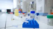 Académie de médecine recommande le dépistage génétique pour tous les futurs parents
