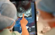 Endométriose digestive : une nouvelle technique non invasive au CHU de Toulouse