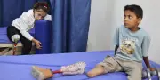 À Gaza, le traumatisme des enfants mutilés par la guerre