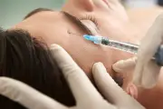 Injections esthétiques : seuls les médecins sont autorisés en France