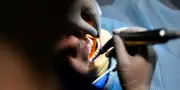Marseille : dentiste condamné pour escroquerie à la Sécu de 2,6 M€