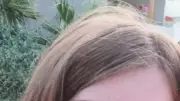 Mobilisation pour Lou, 14 ans : traitement vital contre leucémie agressive