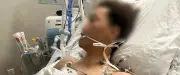 Poignardé à cinq reprises au Corum, un Montpelliérain témoigne