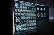 Un Gallois de 34 ans atteint d'une tumeur cérébrale après des maux de tête