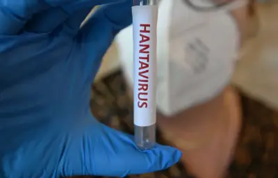 Hantavirus : les contacts du touriste invités à s'isoler
