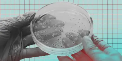 Légionellose en Savoie : un restaurant de Chambéry source de l'infection