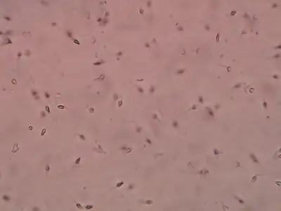 NoFap : masturbation et fertilité, mythes et réalités scientifiques