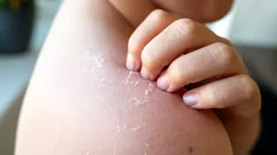 Squishy explose et brûle grièvement un enfant de 8 ans à Saint-Omer