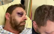 Agression homophobe à Paris : le président de FLAG! grièvement blessé