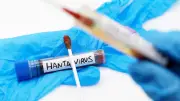 Hantavirus Andes : un cas importé détecté en France fin juillet
