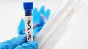 Hantavirus : isolement des cas contacts du touriste contaminé en France