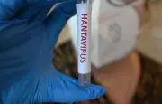 Hantavirus : les contacts du touriste invités à s'isoler