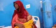 Somalie : la moitié des enfants déplacés souffrent de malnutrition aiguë