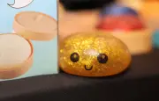 Squishy explose : un garçon de 8 ans grièvement brûlé à Saint-Omer