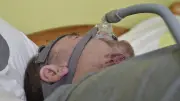 Apnée du sommeil : le CHU de Montpellier innove avec un implant sans masque